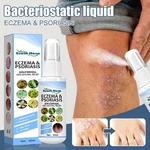 30ml Skin Psoriasis Spray Natural Herb Eczema Treatment Itch Relief New. Fixed Price $6.99.